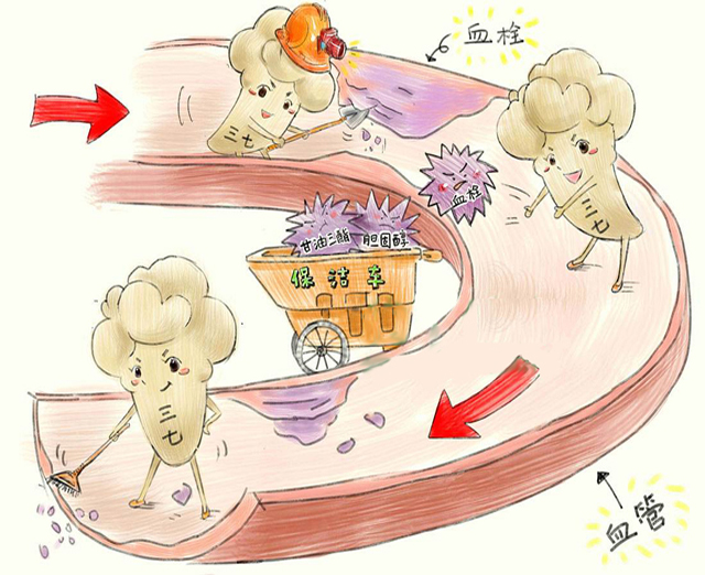 血管清理
